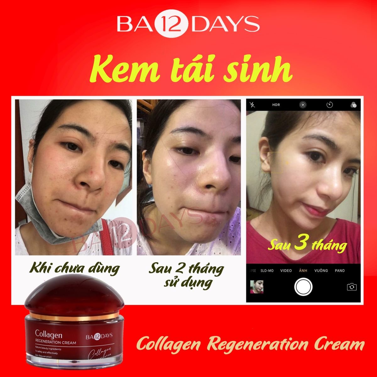 Kem face Collagen tái tạo da Ba12days Cosmetics giúp tái sinh làn da hoàn hảo, trẻ hóa làn da