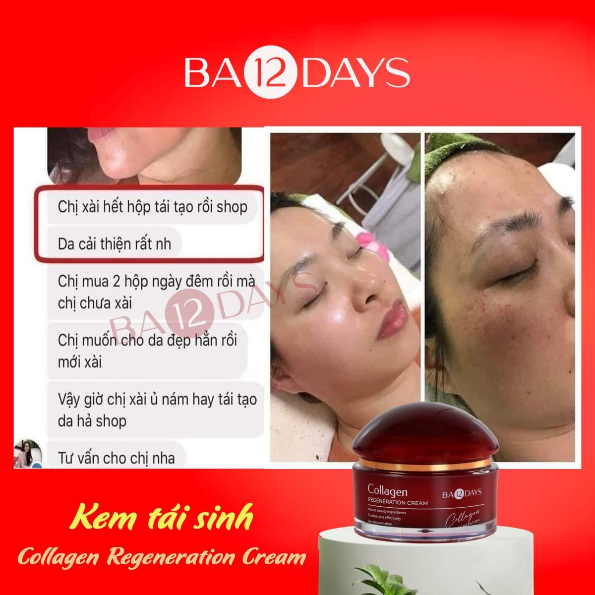 Kem dưỡng tái sinh Collagen Regeneration Cream Ba12days Cosmetics giúp 