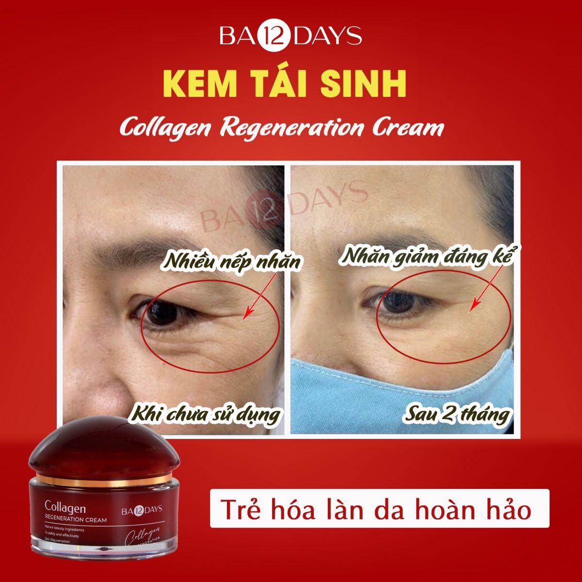 kem dưỡng tái tạo da nào tốt bằng kem dưỡng tái sinh Collagen Regeneration Cream Ba12days Cosmetics, giúp giảm các rãnh nhăn, vết chân chim trên khóe mắt